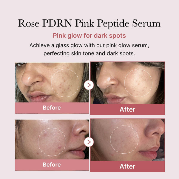 Stärkt die Hautbarriere