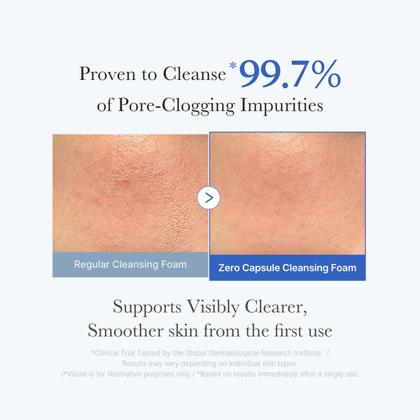 Exfoliation douce multi-acides