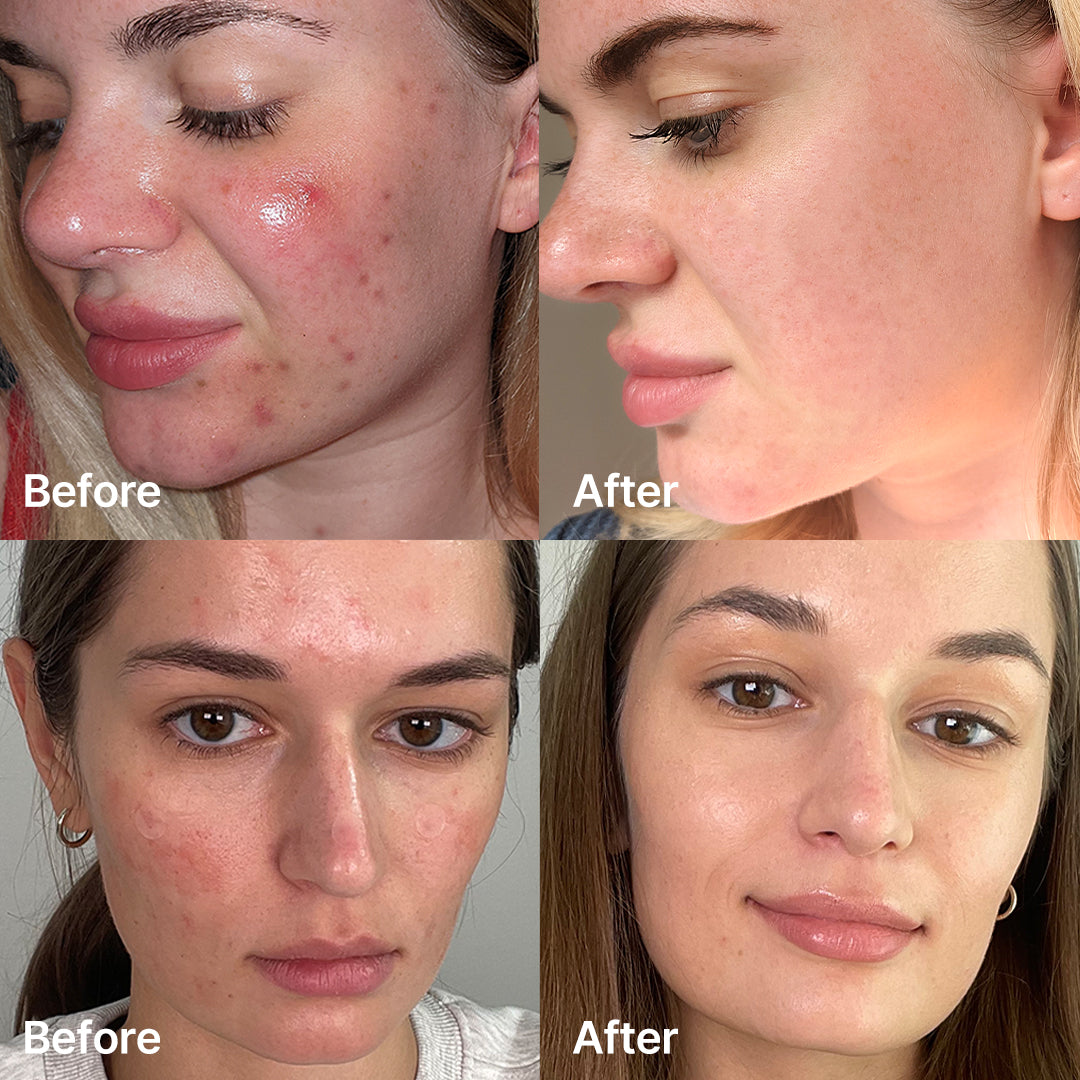 Red Succinic Acid Serum